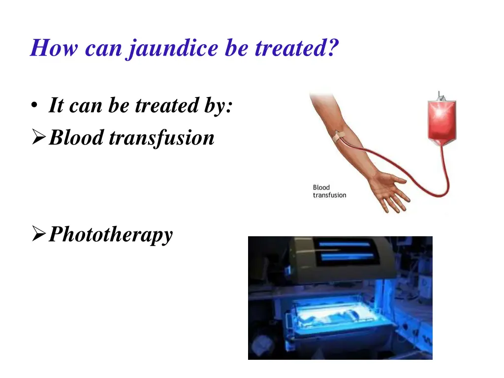 how can jaundice be treated