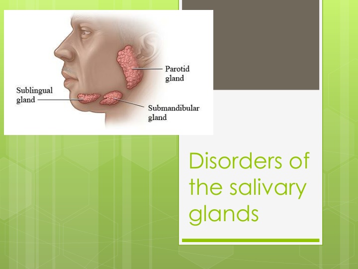 disorders of the salivary glands