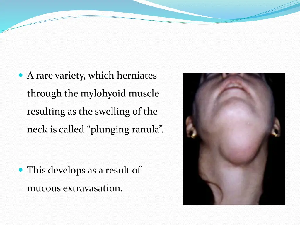 a rare variety which herniates