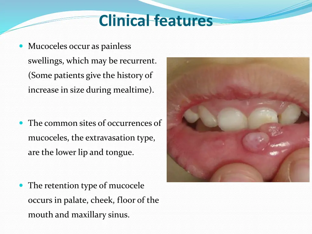 clinical features