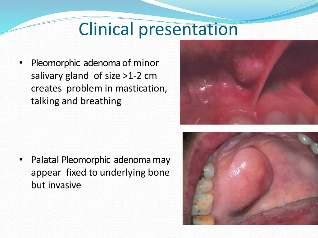 clinical presentation 1