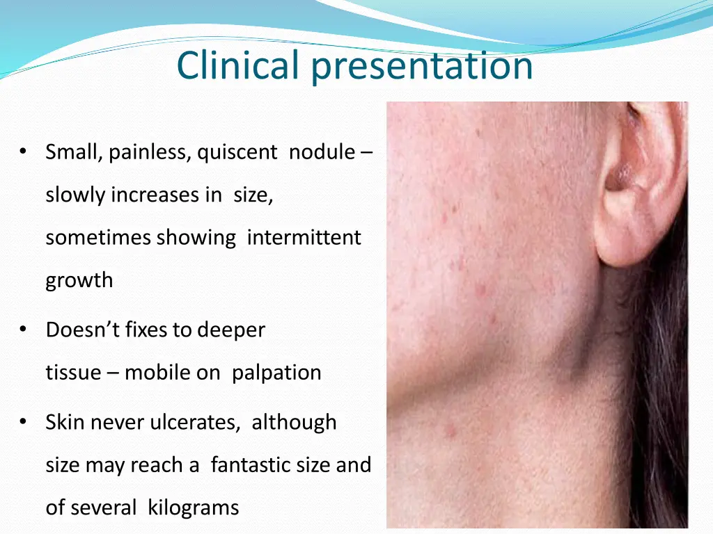 clinical presentation