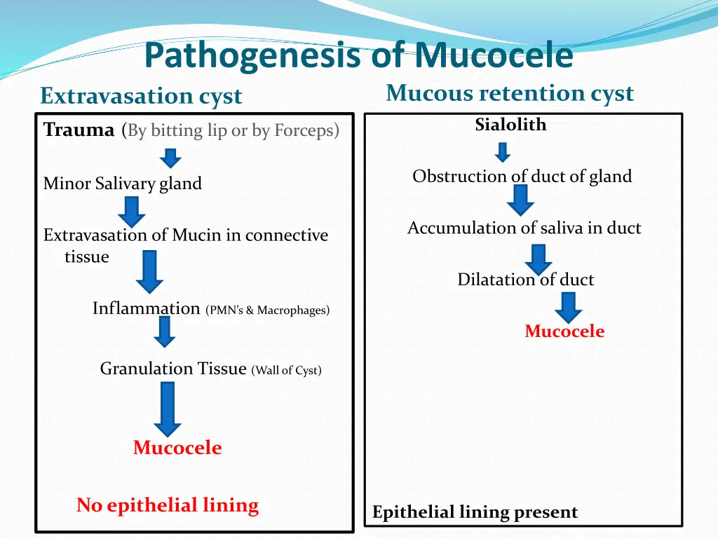 pathogenesis of mucocele extravasation cyst