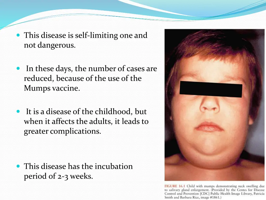 this disease is self limiting