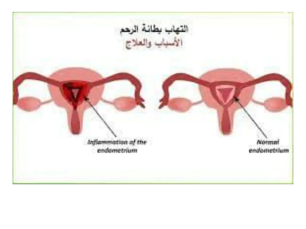 slide19