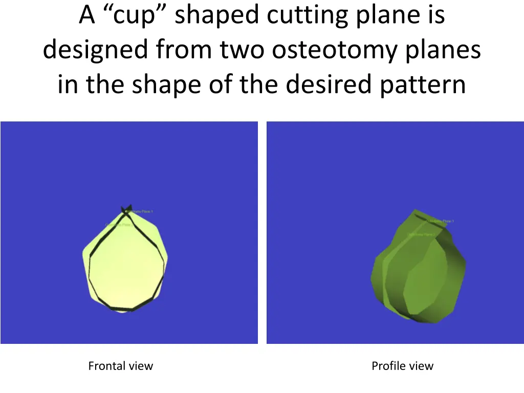 a cup shaped cutting plane is designed from