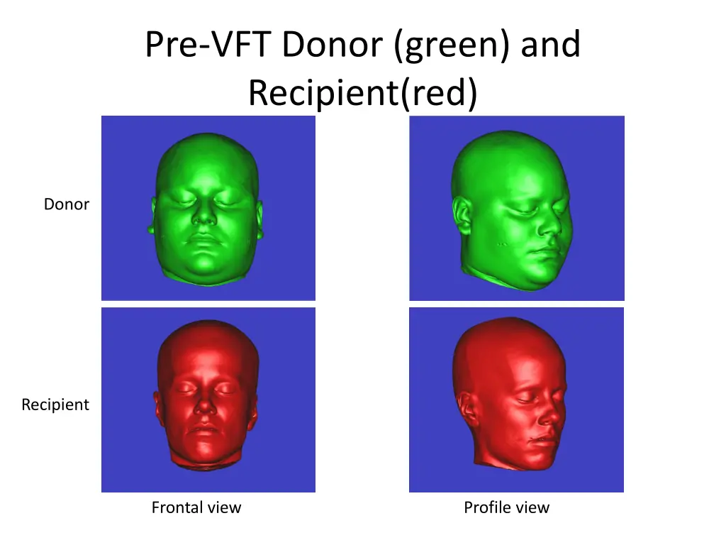 pre vft donor green and recipient red