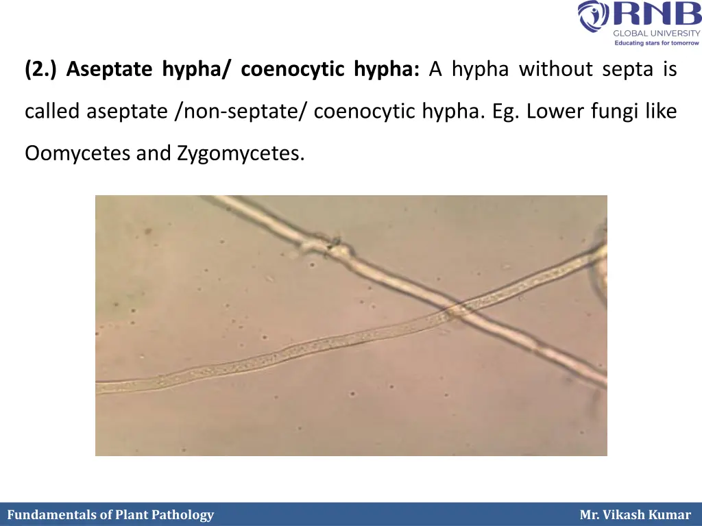2 aseptate hypha coenocytic hypha a hypha without