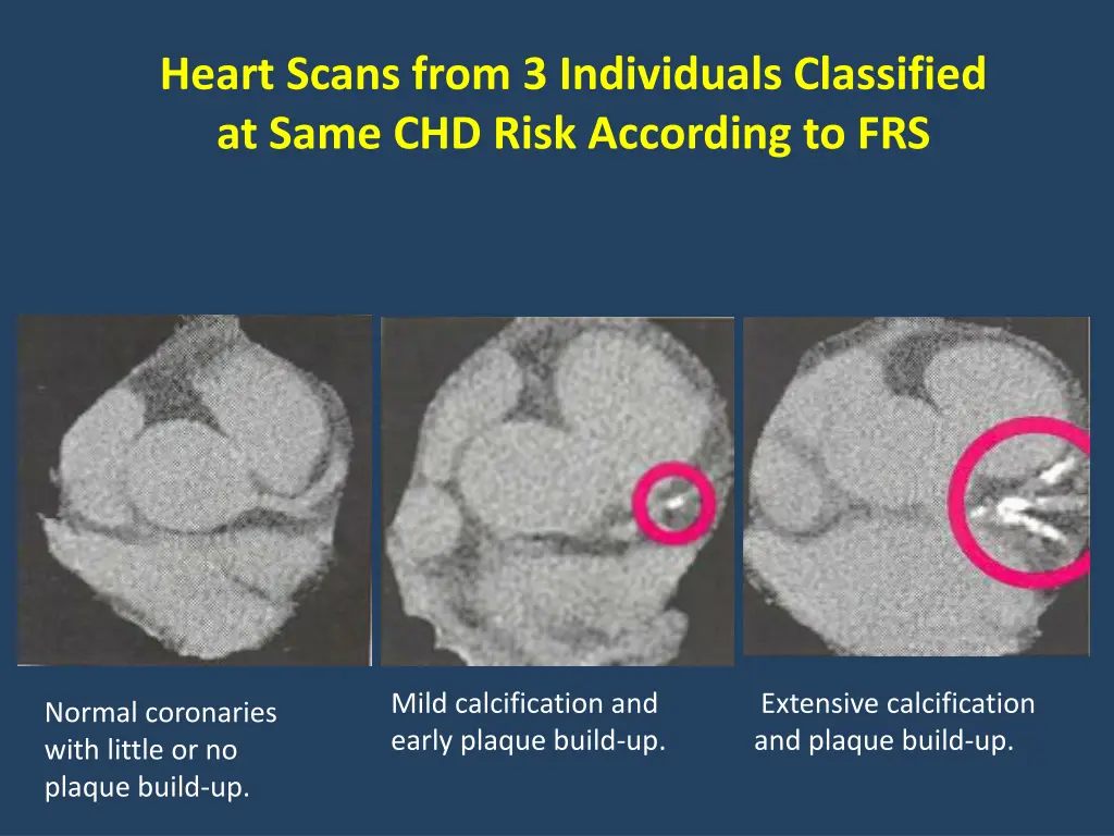 heart scans from 3 individuals classified at same