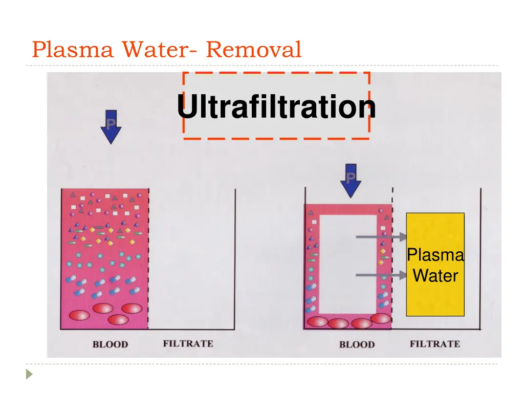 plasma water removal