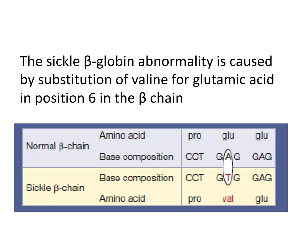 the sickle globin abnormality is caused