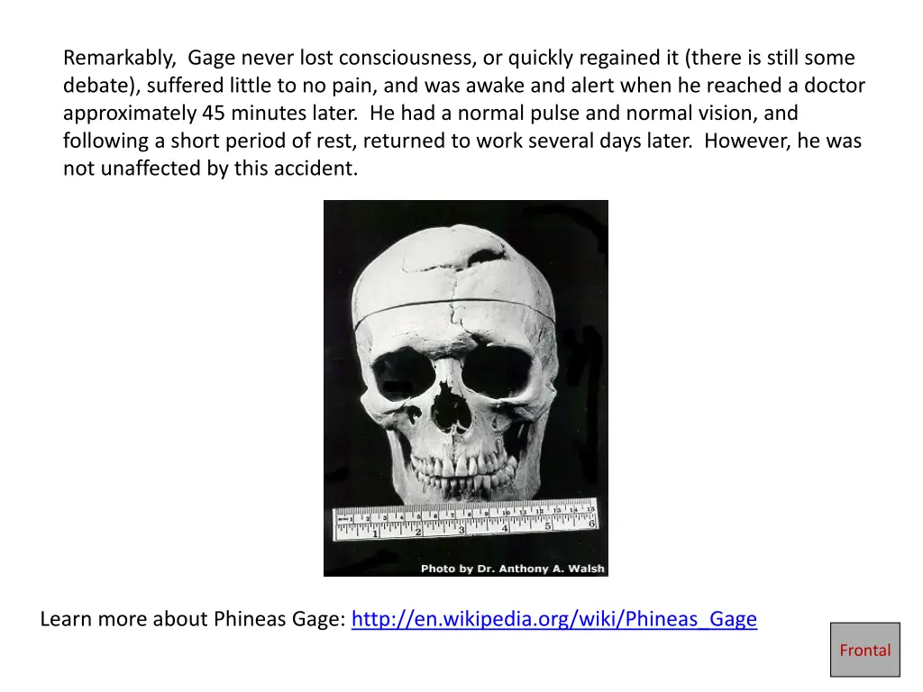 remarkably gage never lost consciousness