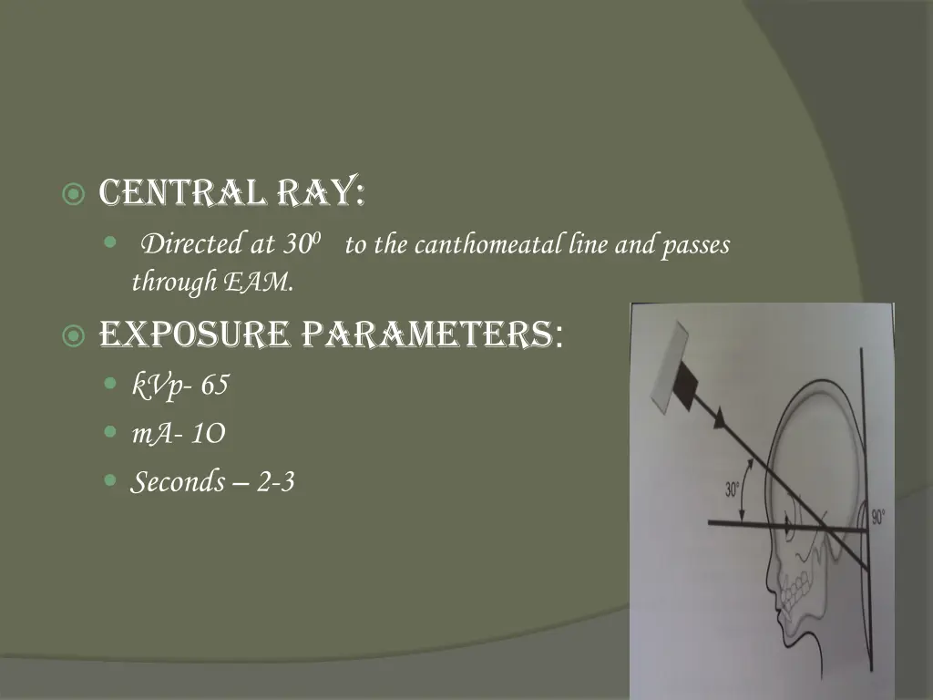 central ray directed at 30 0 to the canthomeatal