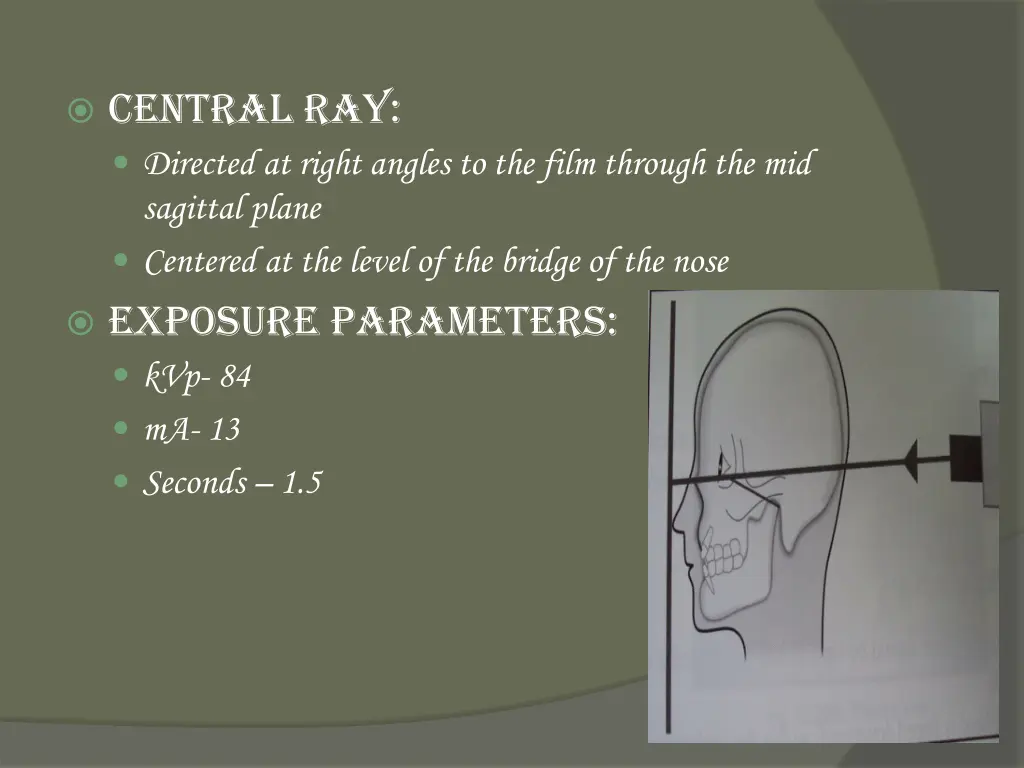 central ray directed at right angles to the film