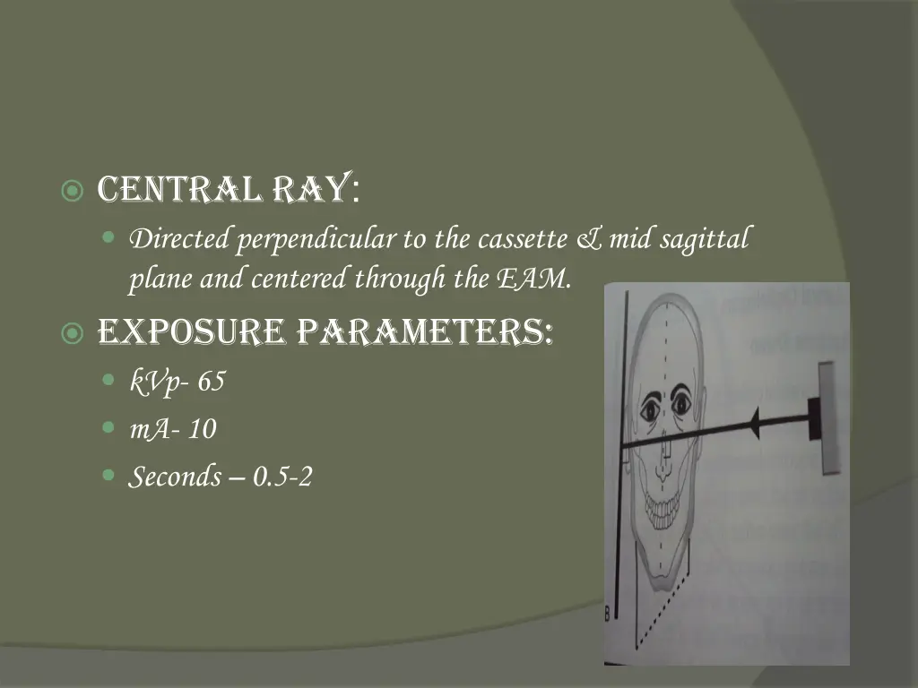central ray directed perpendicular