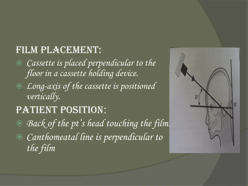 film placement cassette is placed perpendicular