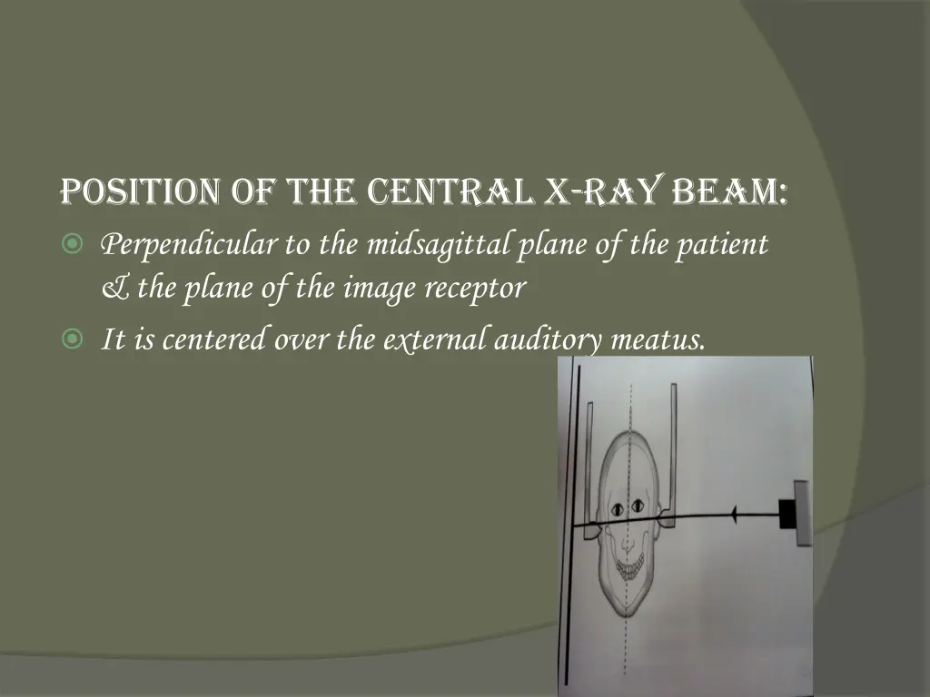 position of the central x ray beam perpendicular
