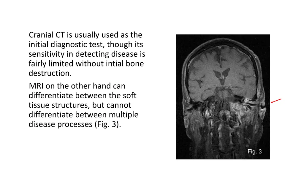 cranial ct is usually used as the initial