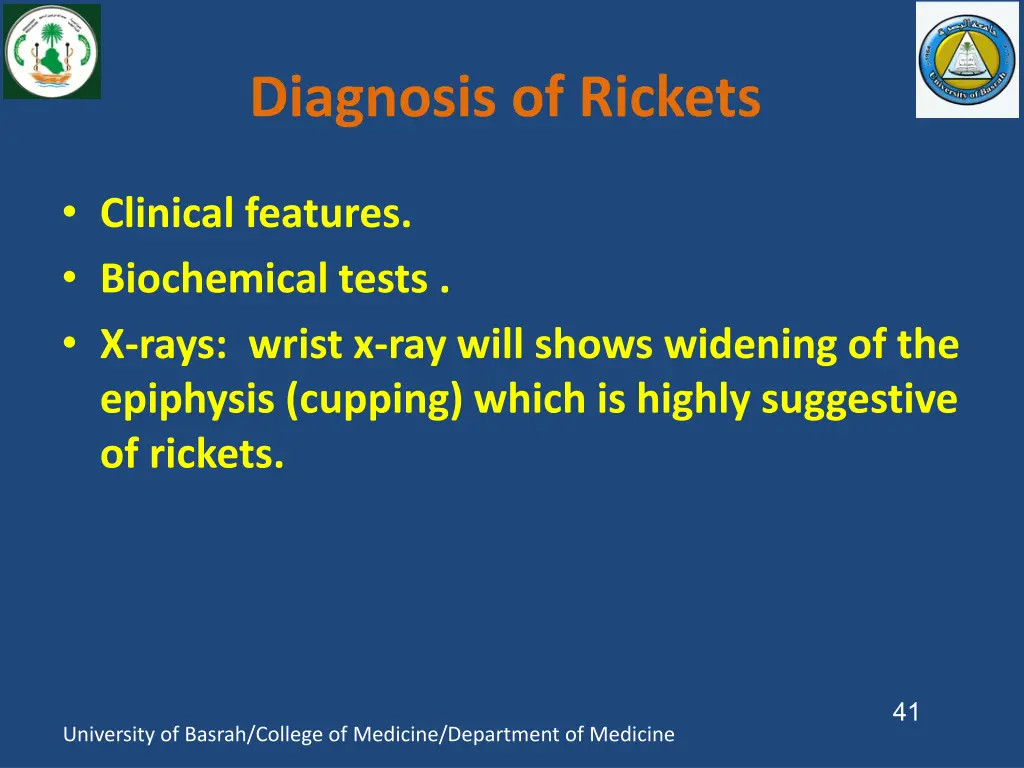 diagnosis of rickets