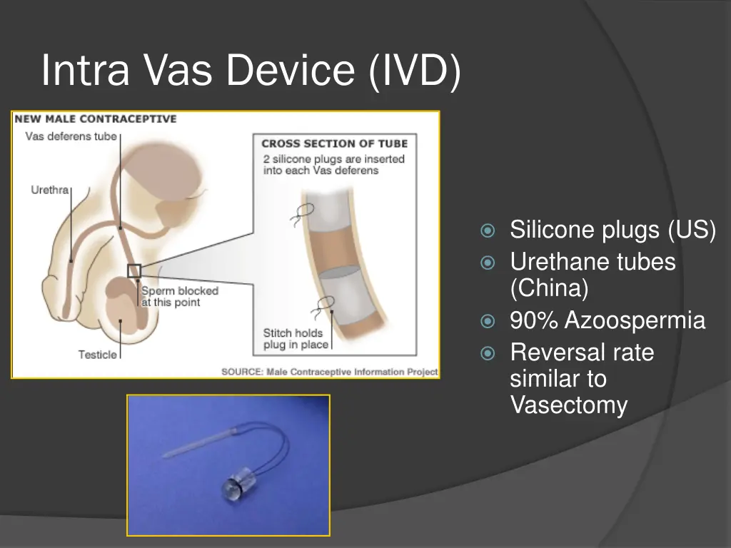intra vas device ivd