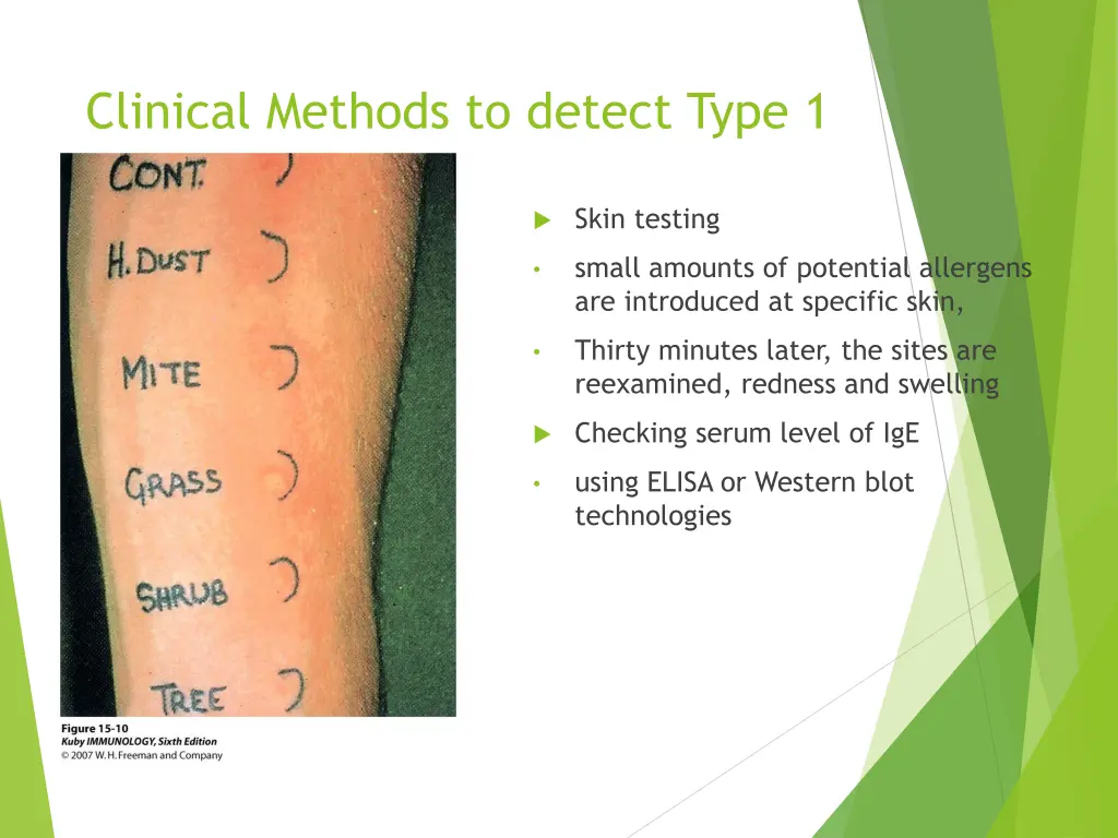 clinical methods to detect type 1