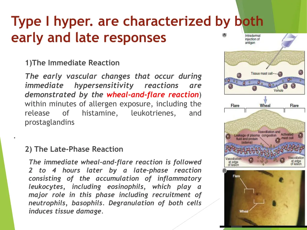 type i hyper are characterized by both early