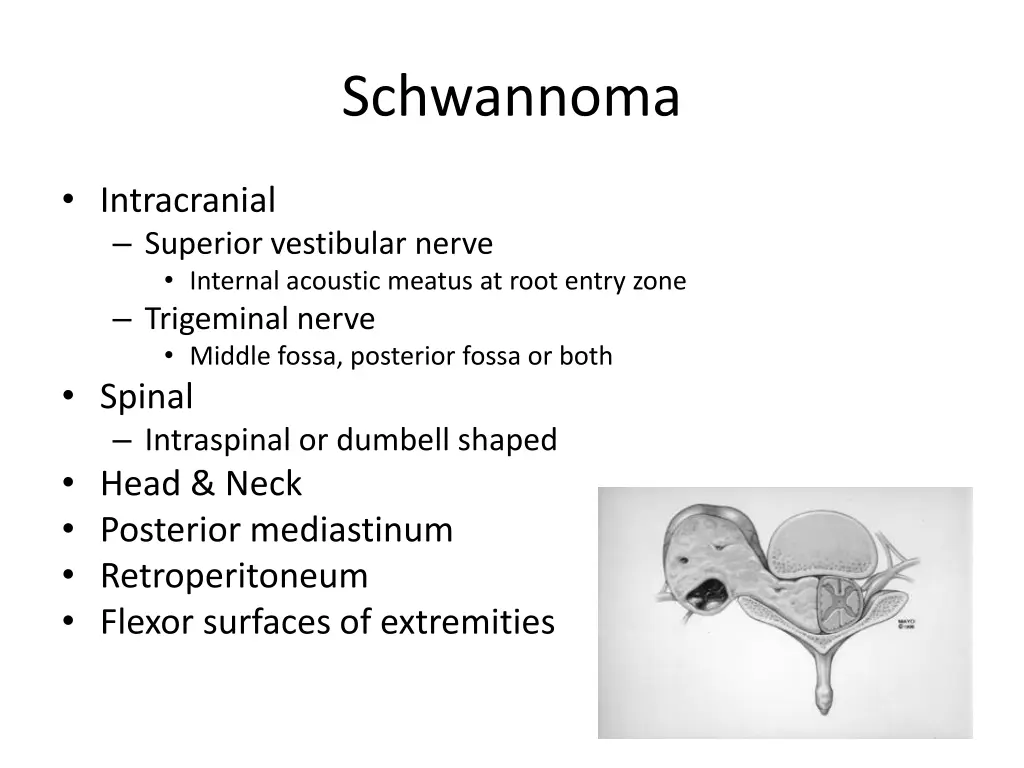 schwannoma 3