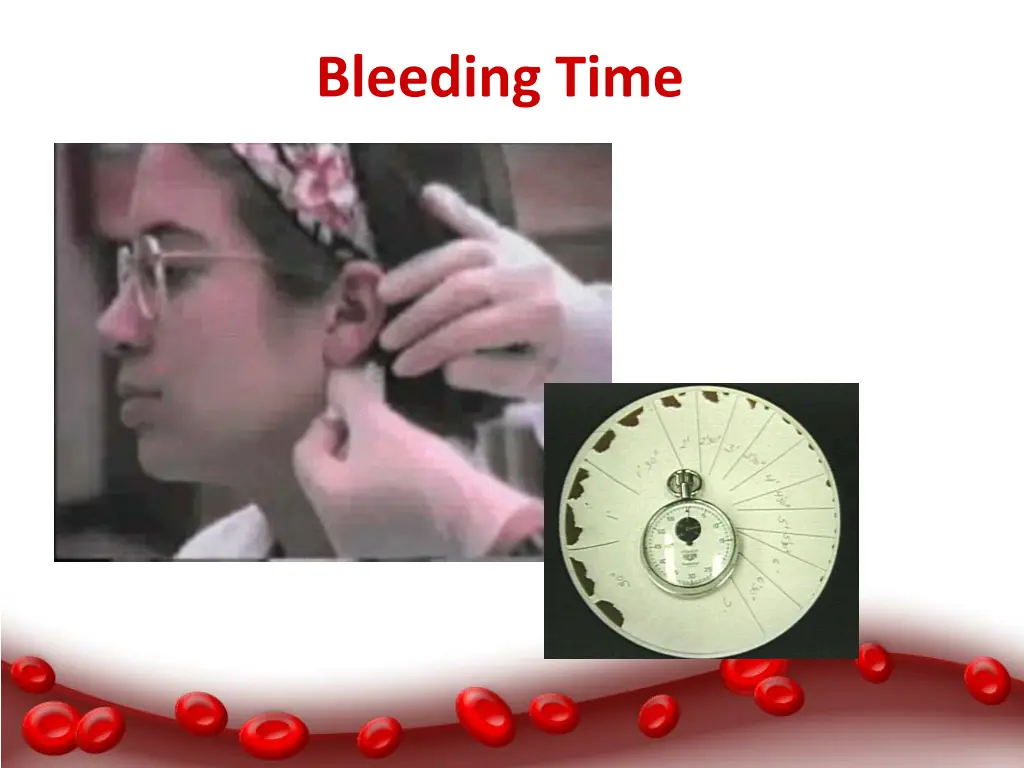 bleeding time 2