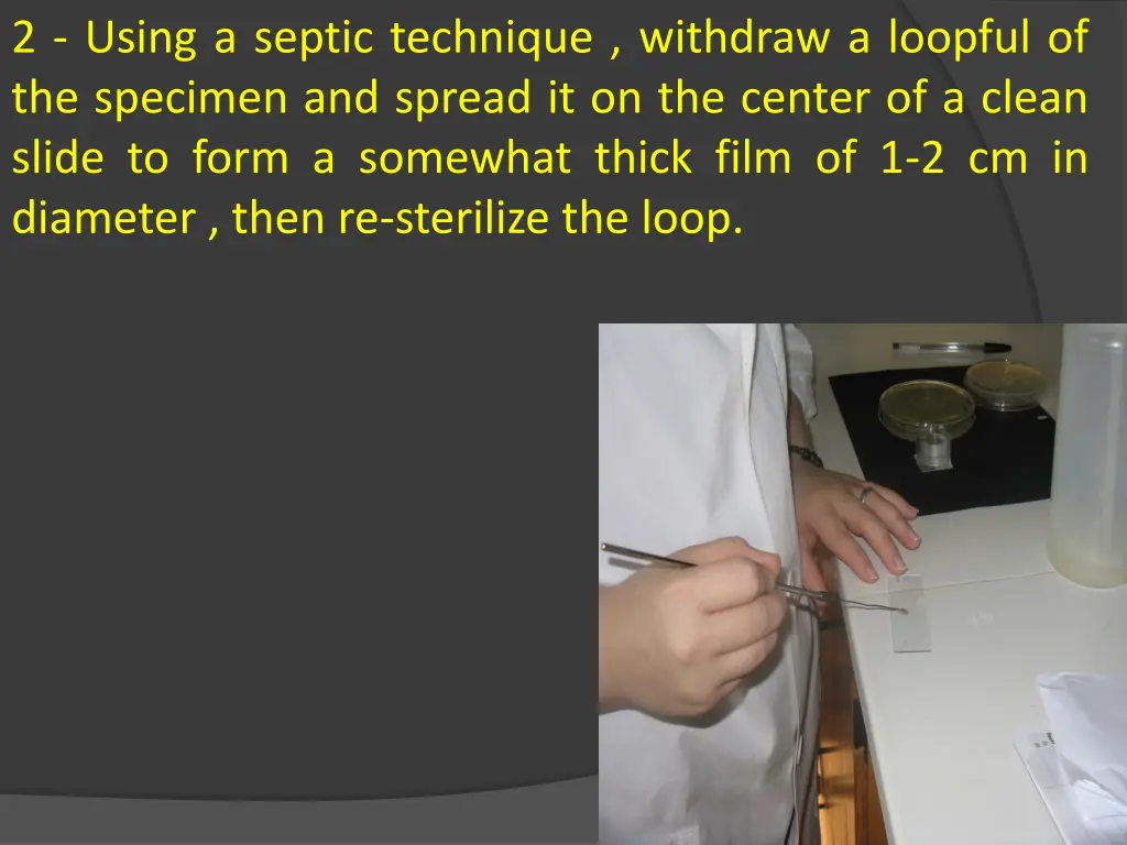 2 using a septic technique withdraw a loopful