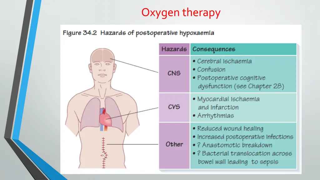 oxygen therapy