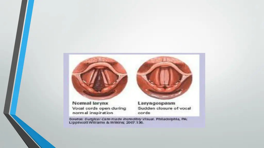 slide14