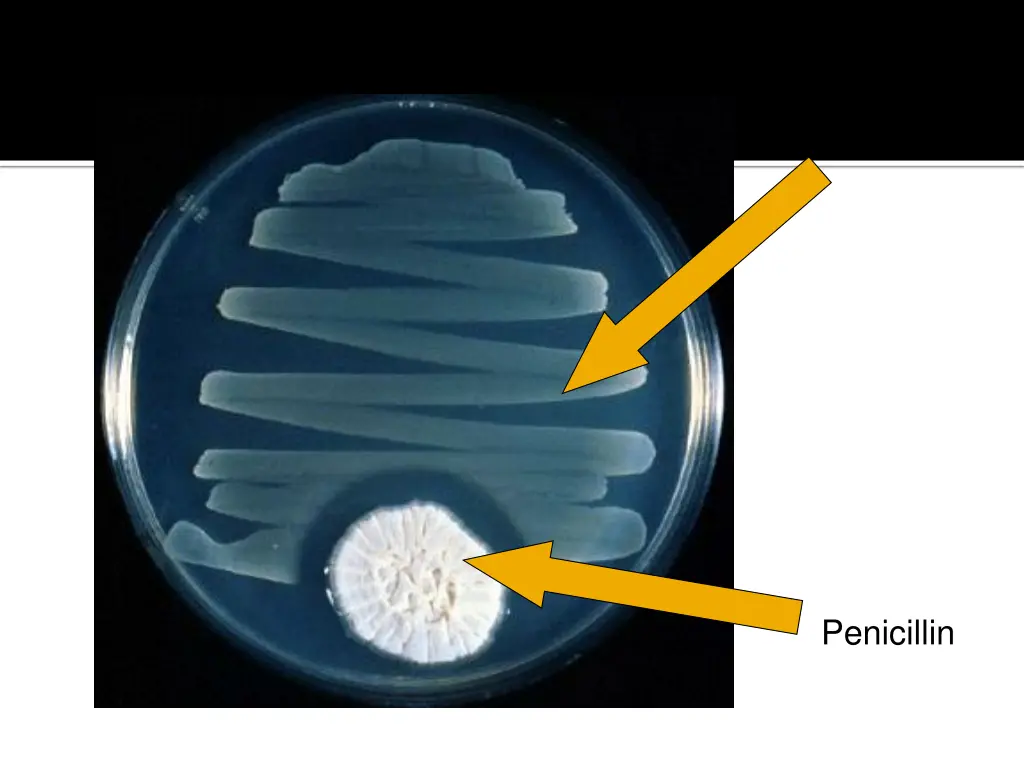 bad bacteria
