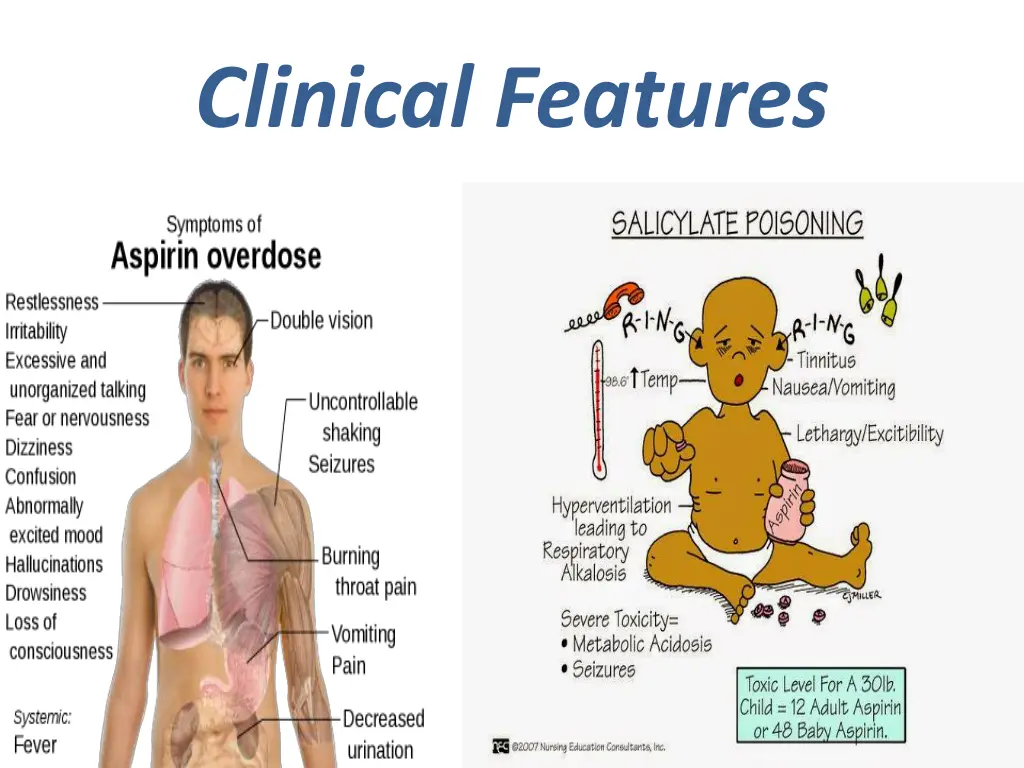 clinical features