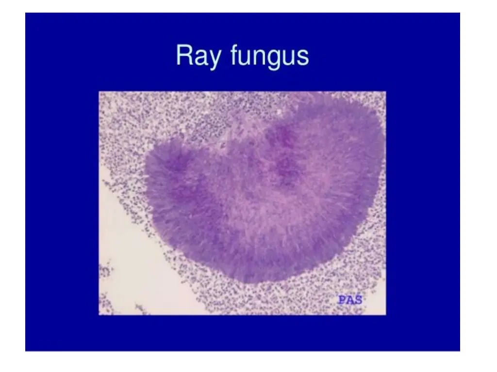 slide14