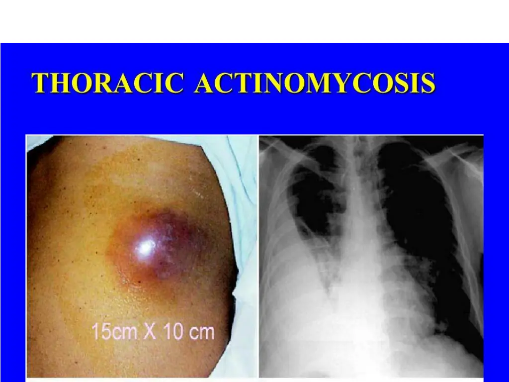 slide21