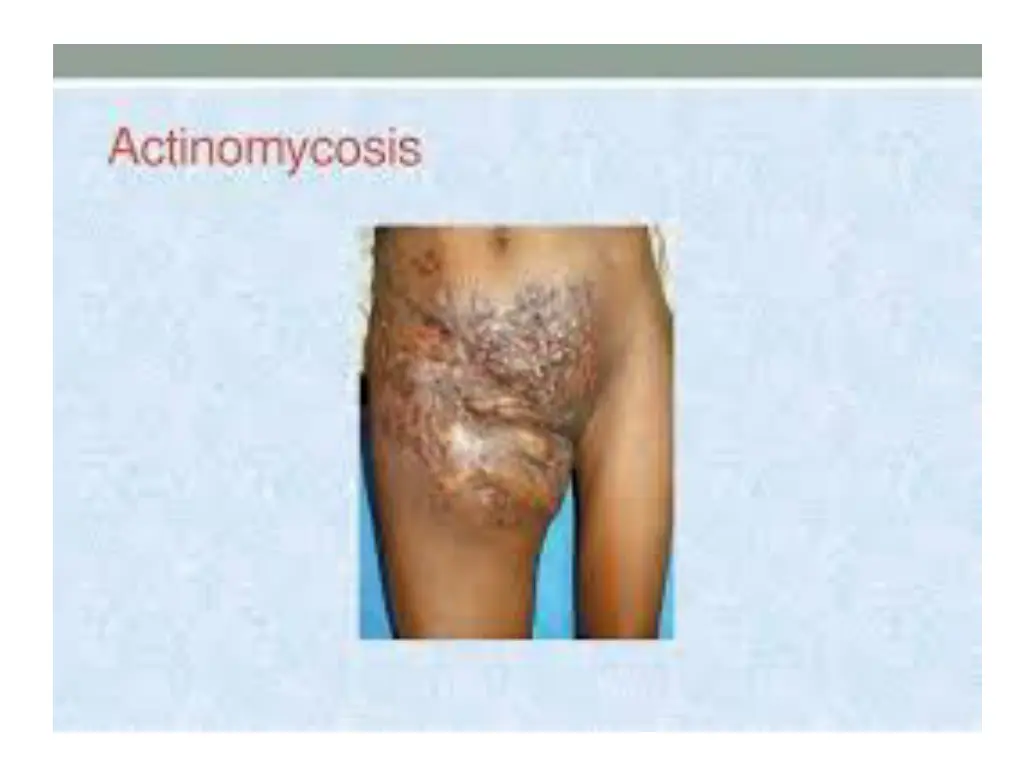slide23