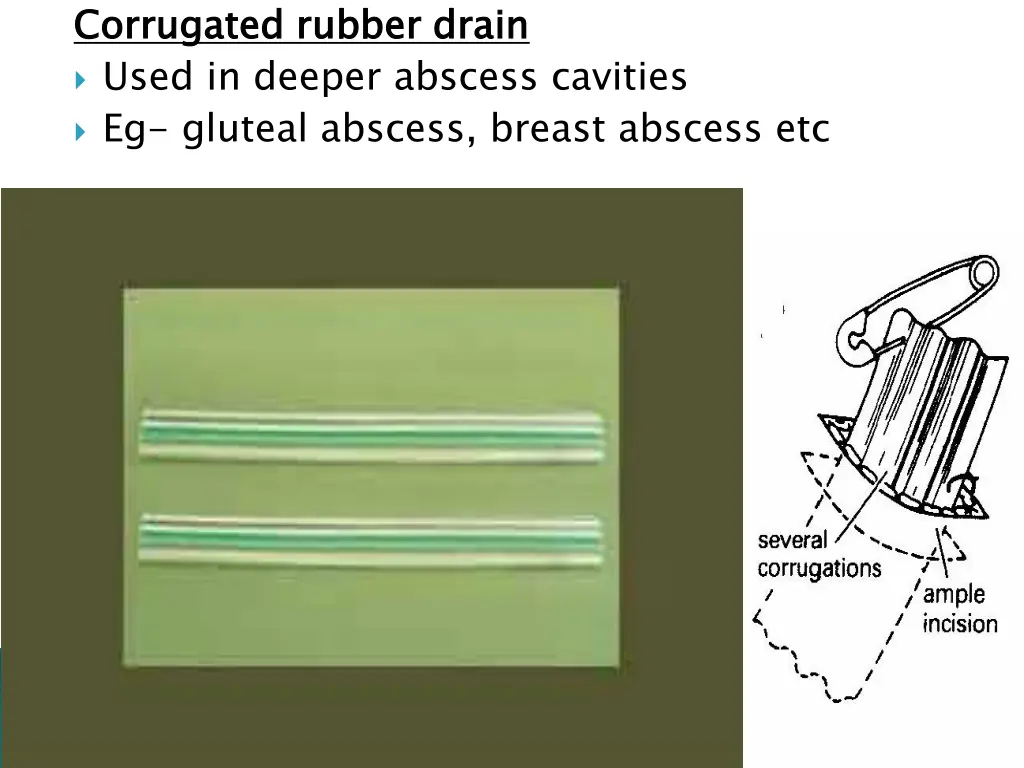 corrugated rubber drain used in deeper abscess