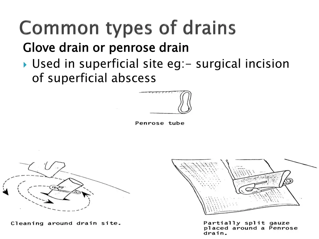 glove drain or used in superficial site
