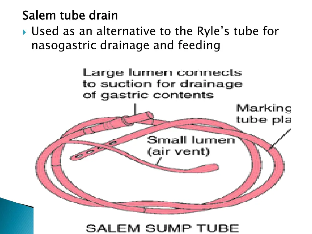 salem tube drain used as an alternative