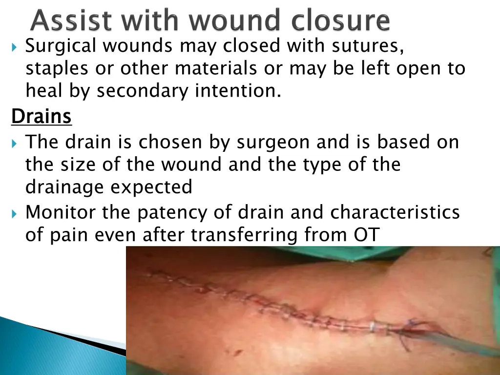 surgical wounds may closed with sutures staples