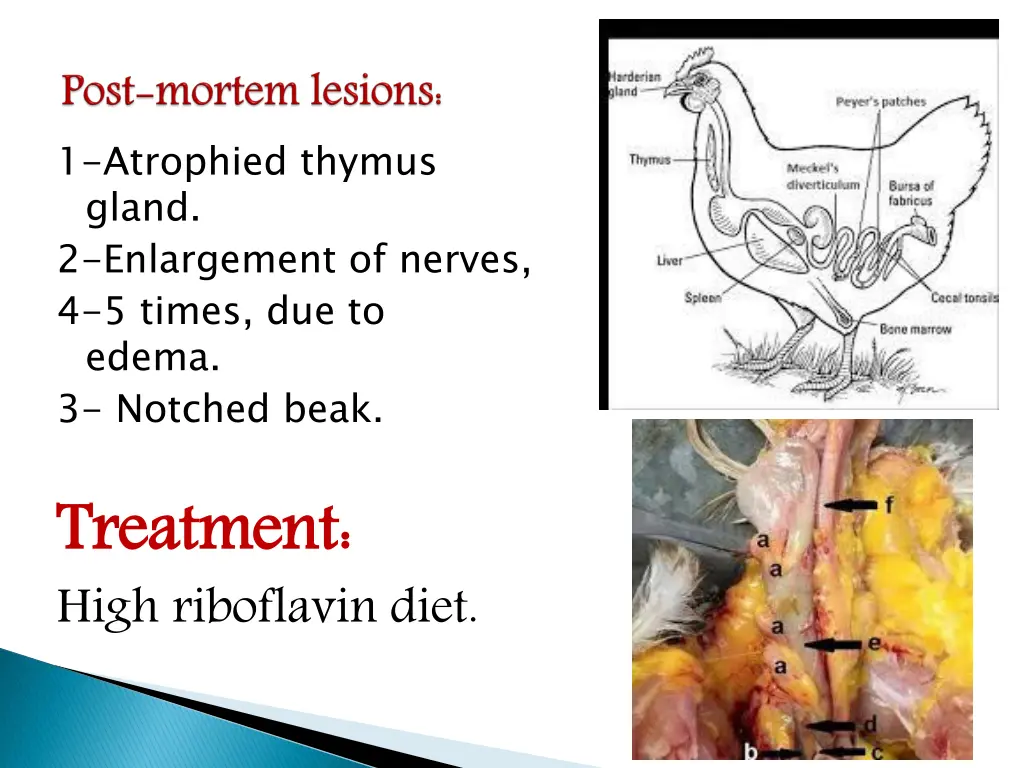 1 atrophied thymus gland 2 enlargement of nerves