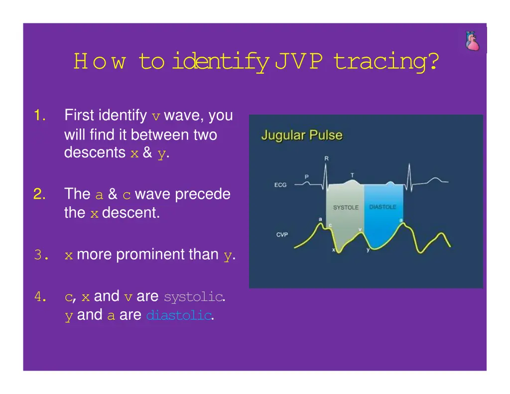 how toidentifyjvp tracing
