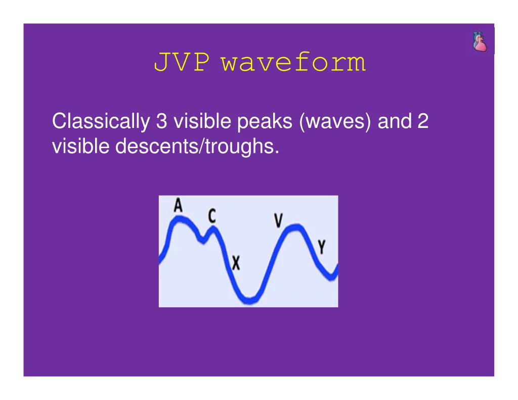jvp waveform