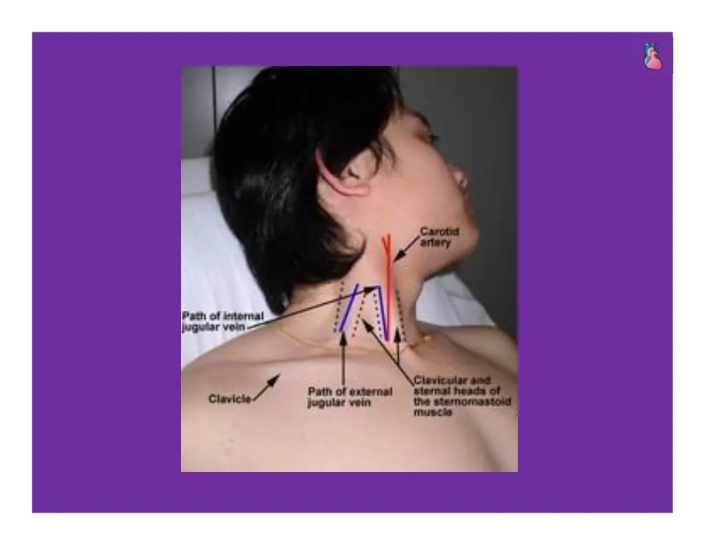 slide14