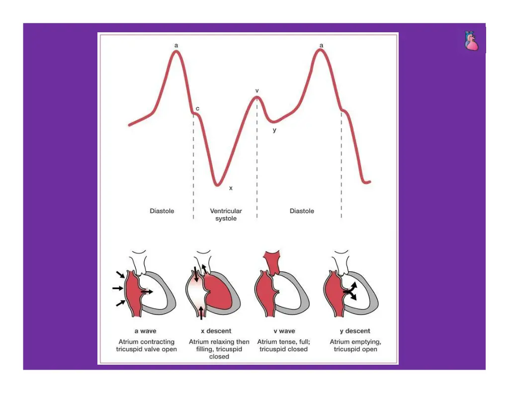 slide18