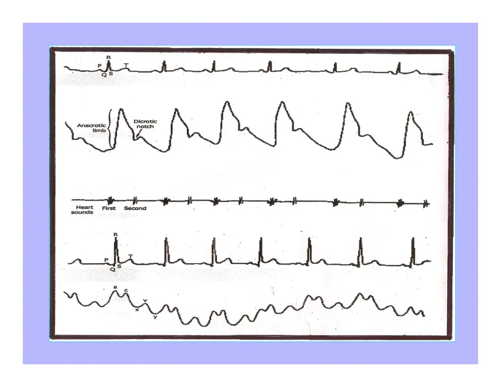 slide22