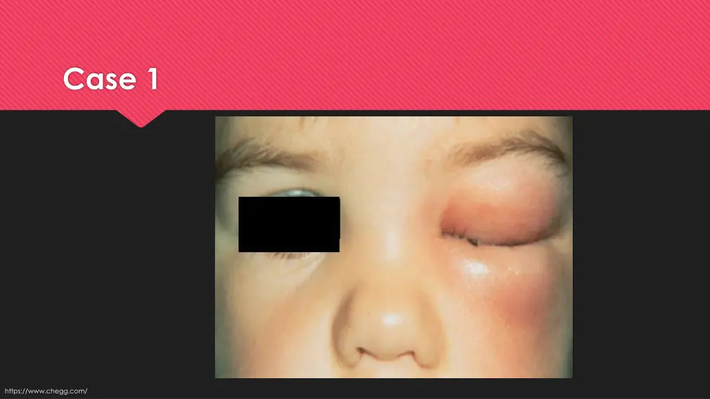 case 1 1