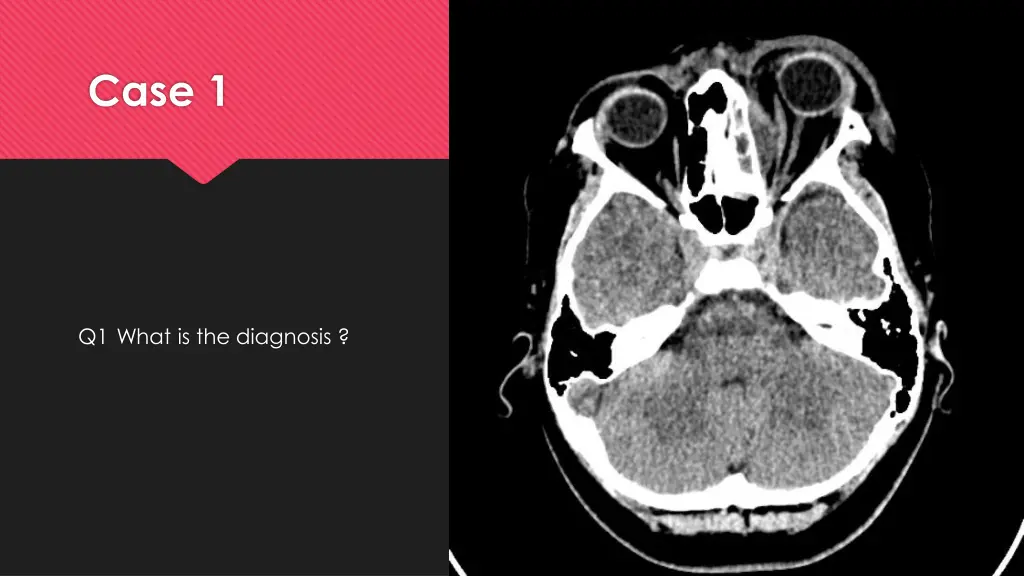 case 1 2