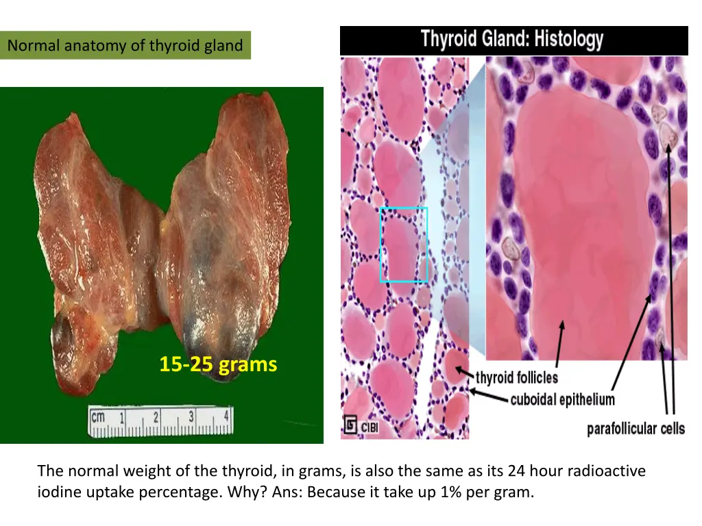normal anatomy of thyroid gland