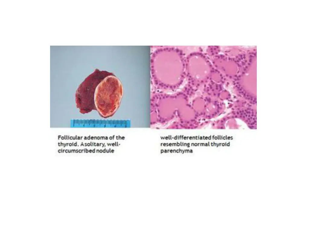 slide19